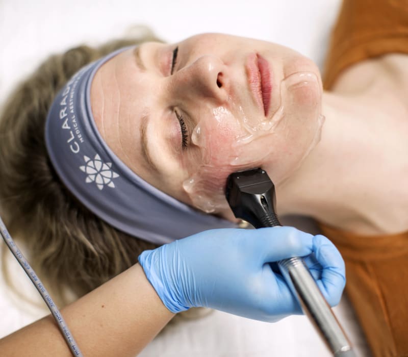 Skin Tightening Treatments, ClaraDerma+