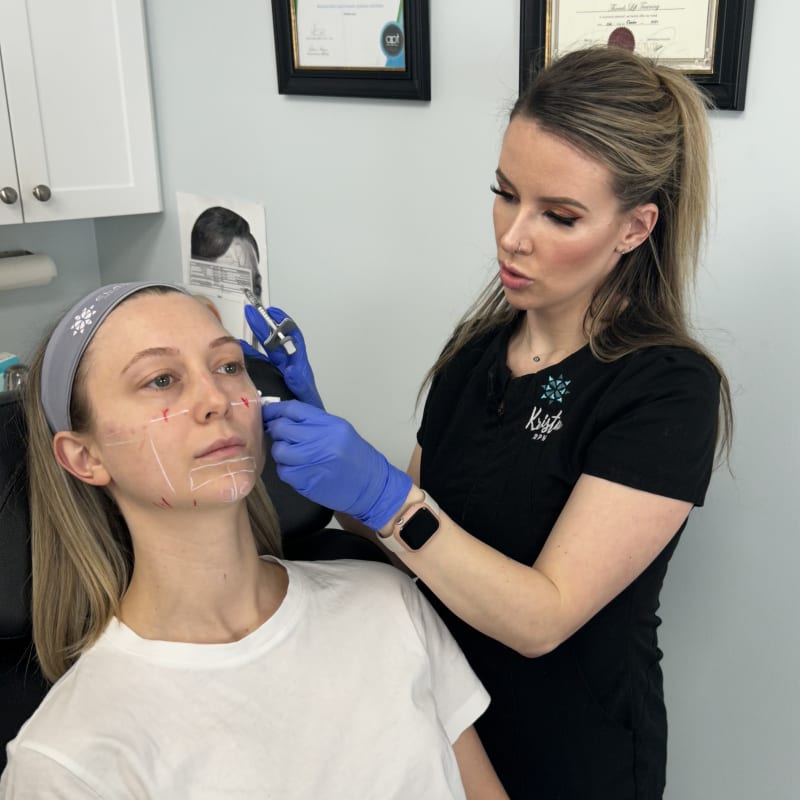 PRP Under Eye Injectables